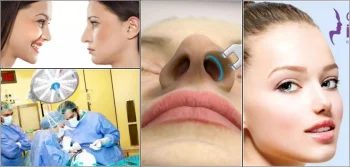 Ameliyatsız Burun Estetiği ve Dolgu Fiyatları